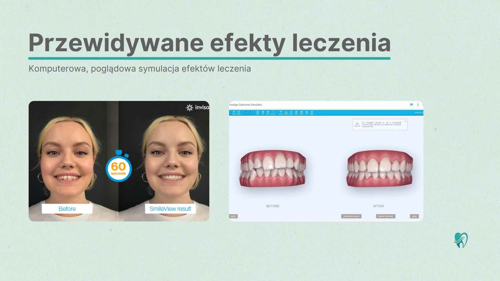Strona z efektami przed i po leczeniu